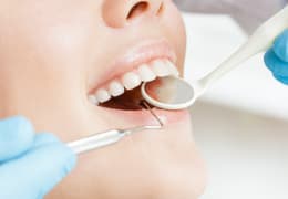 歯を失わないためには早い段階での虫歯治療が必要