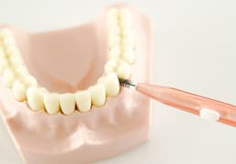 歯間ブラシの正しい使い方 血が出る・入らないといったトラブル原因