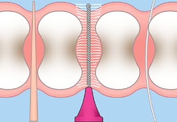 歯間ブラシの正しい使い方