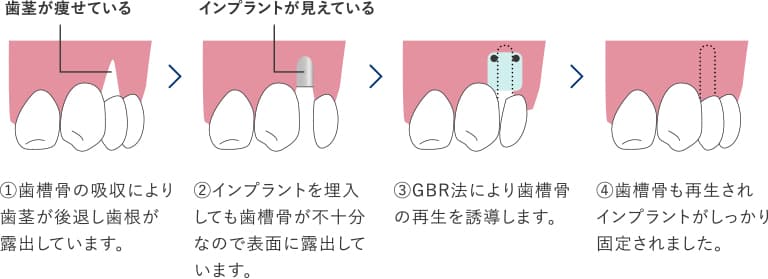 Before After