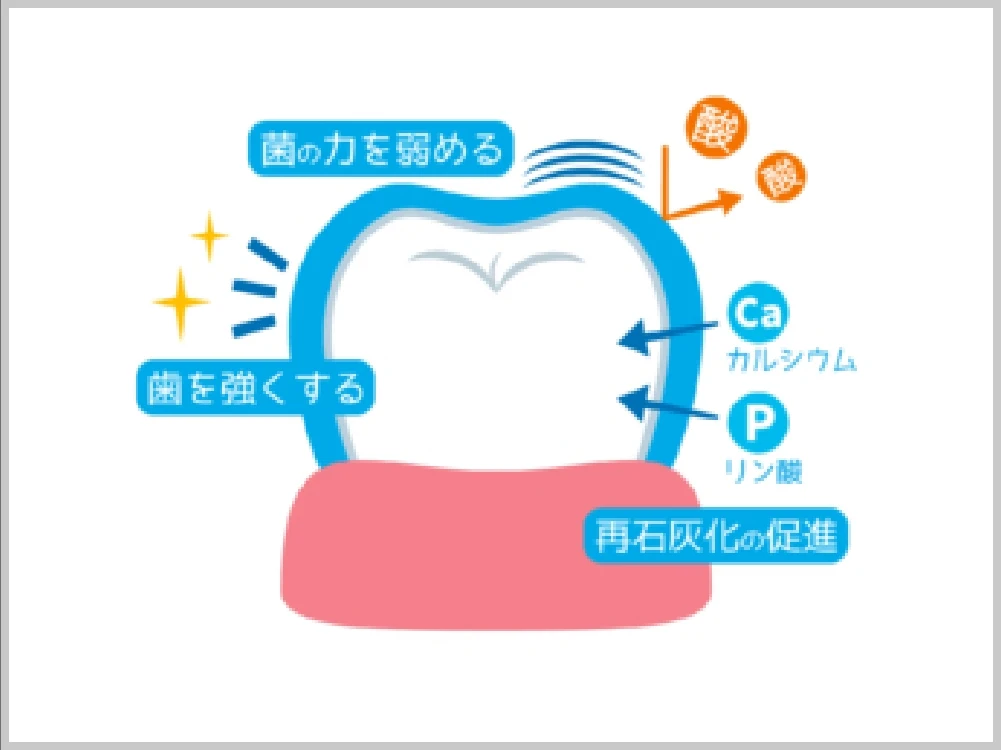 フッ素塗布