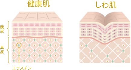コラーゲン・エラスチンの減少