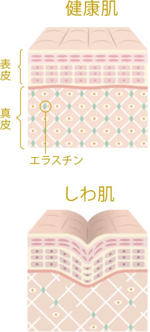 コラーゲン・エラスチンの減少