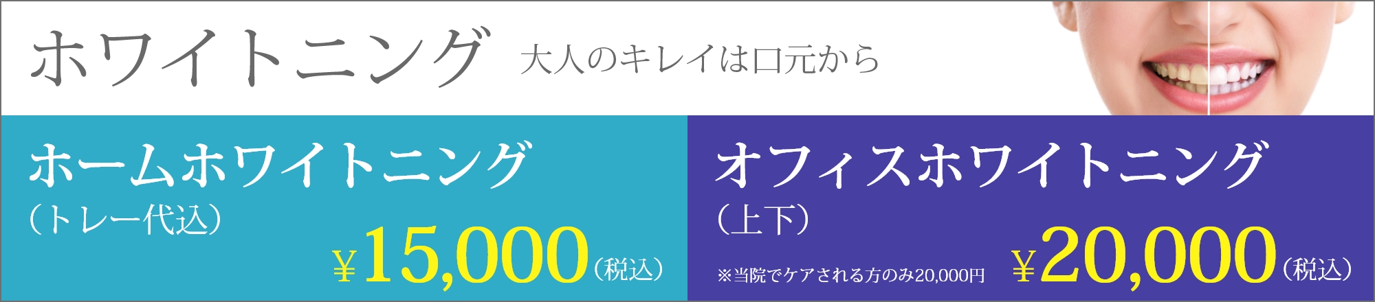 ホワイトニングは西宮北口の長谷川歯科医院まで