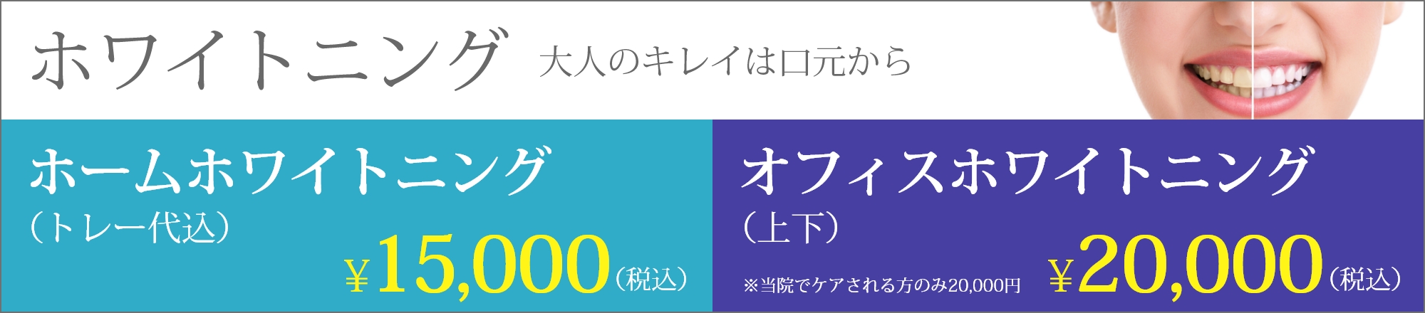 ホワイトニング 大人のキレイは口元から