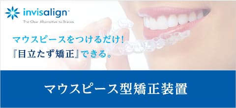 インビザライン マウスピースをつけるだけ！簡単で「目立たず矯正」できる マウスピース型矯正装置