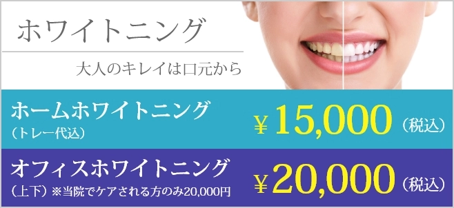 ホワイトニング 大人のキレイは口元から