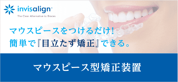 インビザライン マウスピースをつけるだけ！簡単で「目立たず矯正」できる マウスピース型矯正装置